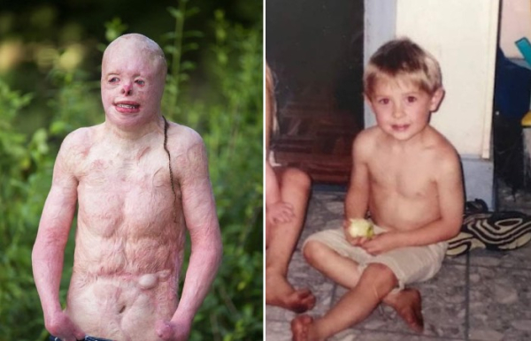 Он почти сгорел, но выжил.