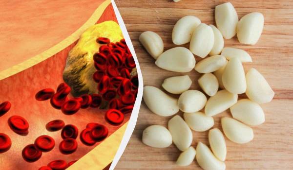 Як часник впливає на рівень холестерину: п'ять ключових ефектів 7